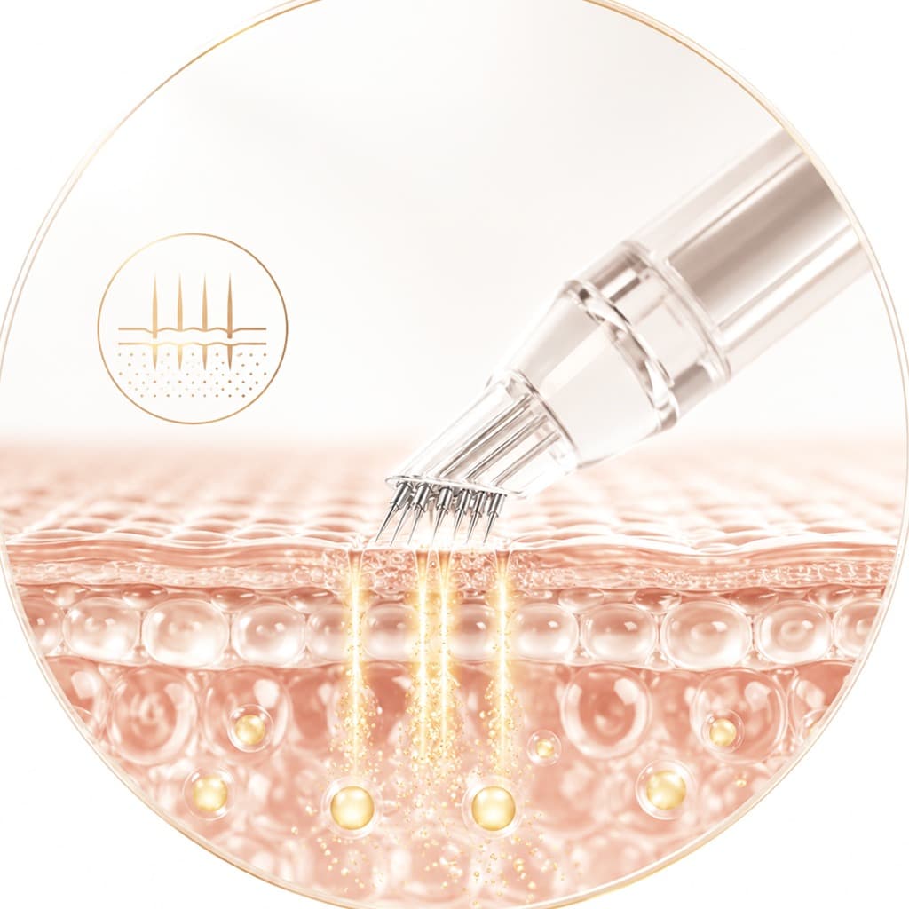 Microneedling-Inspired Technology | La Vie en Rose